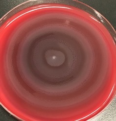 前医でセフカペンピボキシル®️が処方されているurosepsis, 尿に菌がいないがWBC多数、次に参考にする所見は?_d0402367_13102209.jpg