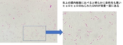 便の塗抹が威力を発揮する唯一無二(と思う)の疾患_d0402367_12584409.jpg