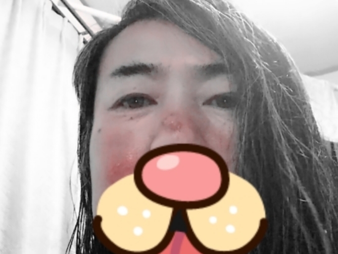 副鼻腔炎でした。_d0378837_12291999.jpg