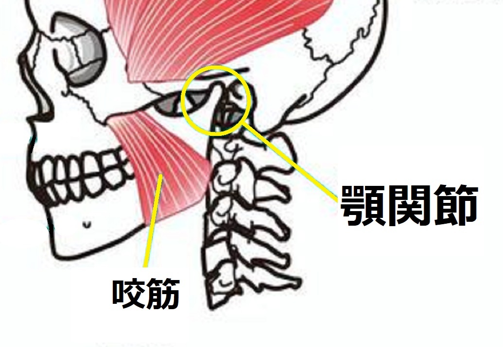 顎関節症_e0246398_18470569.jpg