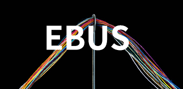 EBUS-TBNAにおける19G針 vs 21/22G針_e0156318_23464676.png