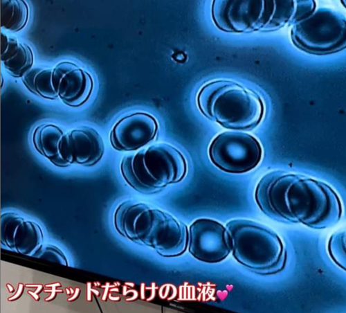 位相差顕微鏡で5人の女性の血液観測！アロマオイル、５-Ala・・にソマチッドたっぷり_d0169072_11083696.jpg