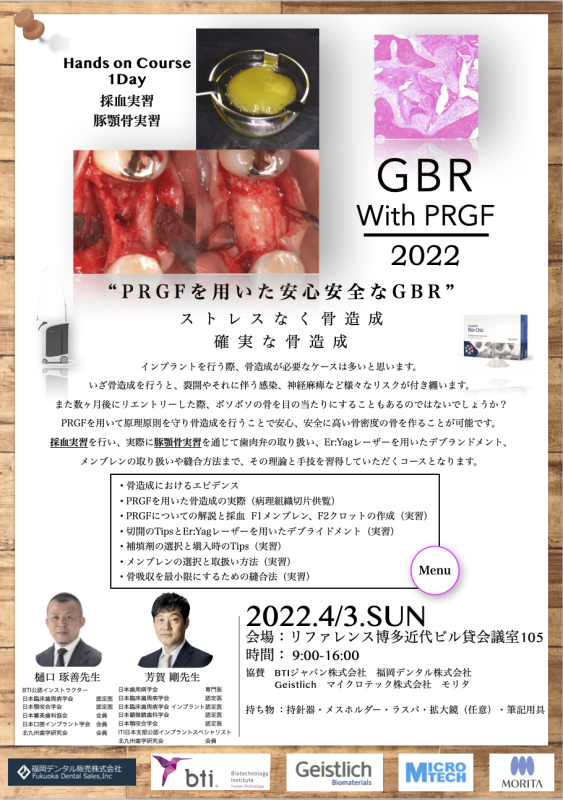 PRGFセミナー IN 博多_d0150056_07110989.png