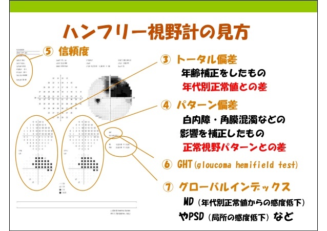 o*o様 みるみるわかる視野検査 : 視野異常パターンの見かた・読みかた : パ 商品詳細ページ | メディカルブックセンター