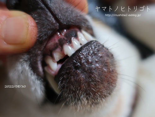 再発アトピーと折れた歯_e0394031_06323447.jpg