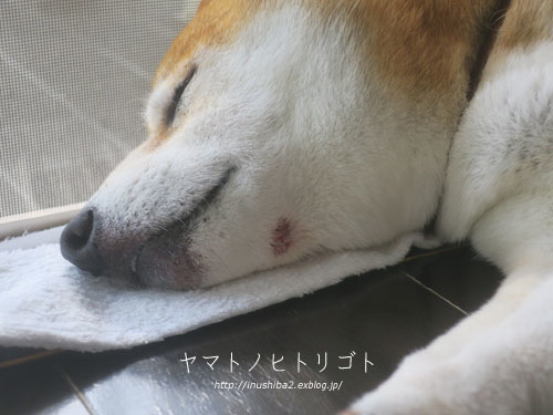 夏の終わりのアトピー_e0394031_06055086.jpg