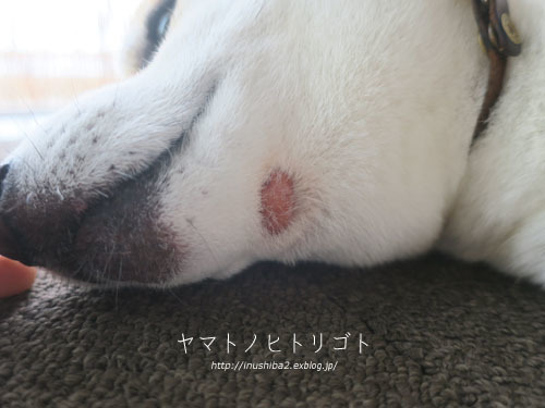 夏の終わりのアトピー_e0394031_06055808.jpg