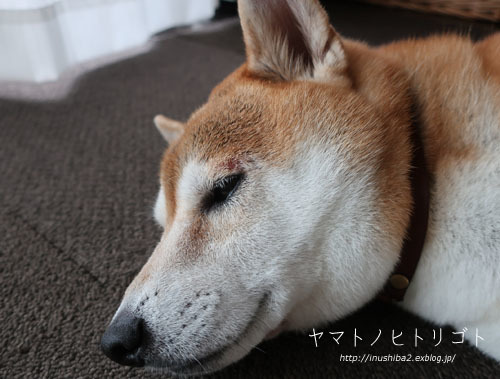 夏の終わりのアトピー_e0394031_06061358.jpg