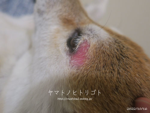 夏の終わりのアトピー_e0394031_06063446.jpg