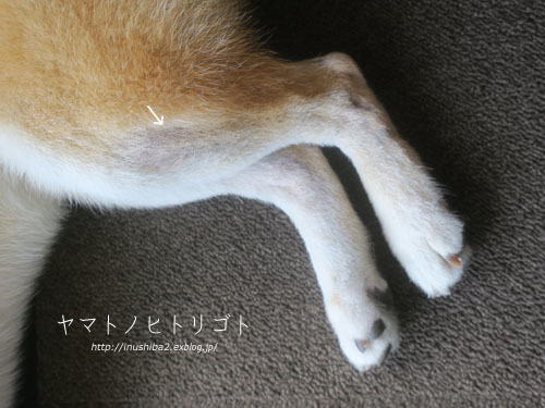 夏の終わりのアトピー_e0394031_06065938.jpg