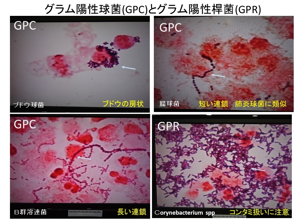 第87回日本泌尿器科学会東部総会　高木院長の発表　短期一般公開　　_a0136788_16472818.jpg