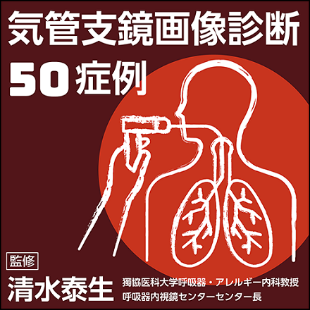電子書籍の紹介：気管支鏡画像診断50症例_e0156318_22041529.png